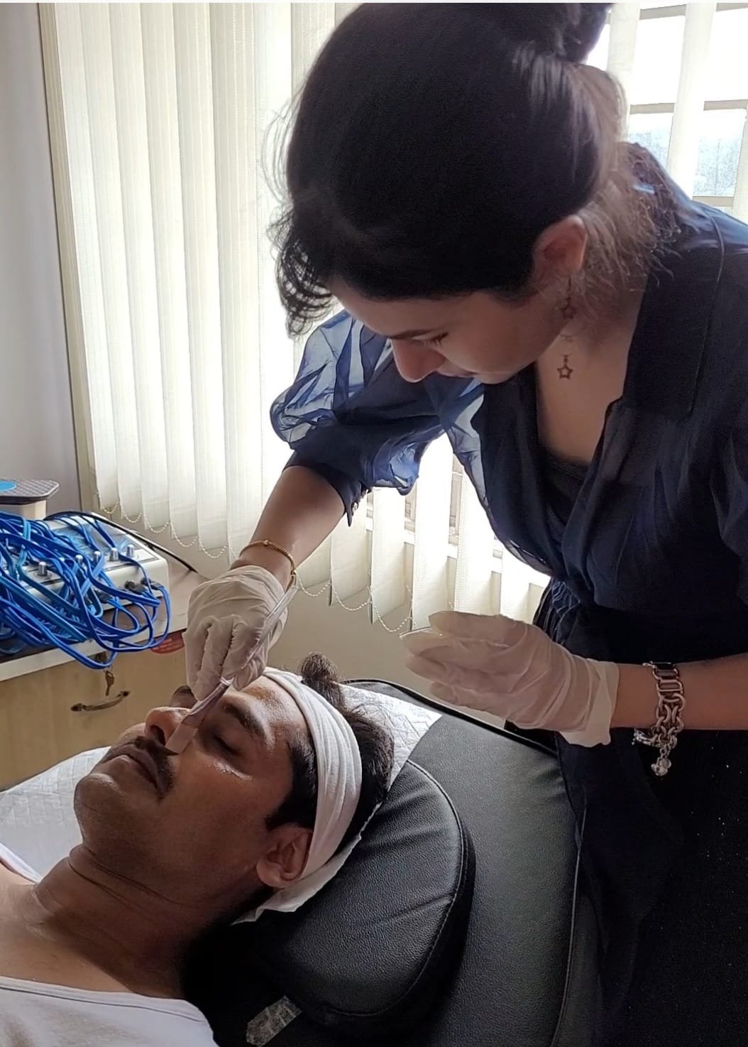 After FUE Hair Transplant